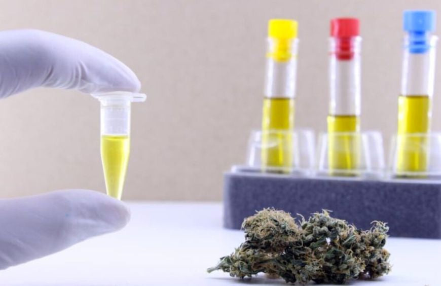Wie lange bleibt CBD im Urin?