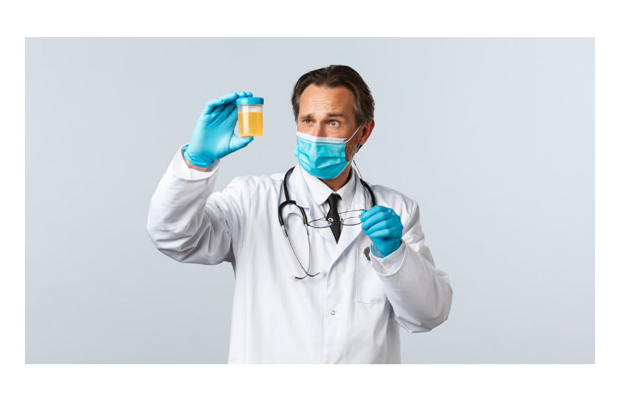 CBD und Urintest: Besteht die Gefahr eines positiven Ergebnisses?