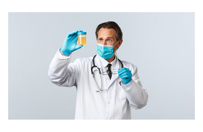 CBD und Urintest: Besteht die Gefahr eines positiven Ergebnisses?